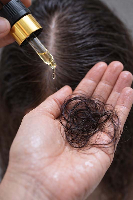ليش يزيد تساقط الشعر بعد وضع الزيت؟ الأسباب الشائعة + كيف تتجنبها